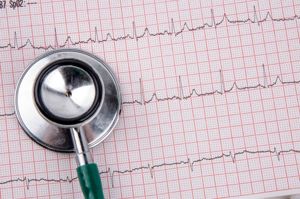 A cardiogram pulse trace. (George Hodan)
