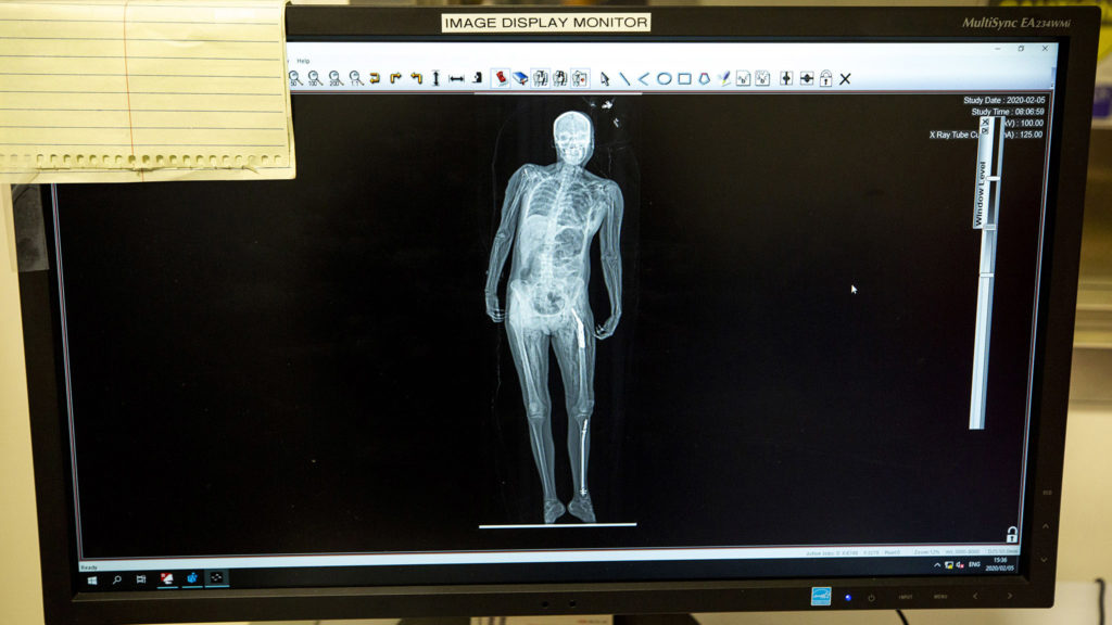A body scanned in the Lodox full-body imaging system newly installed at Denver's Office of the Medical Examiner. Feb. 5, 2020. (Kevin J. Beaty/Denverite)