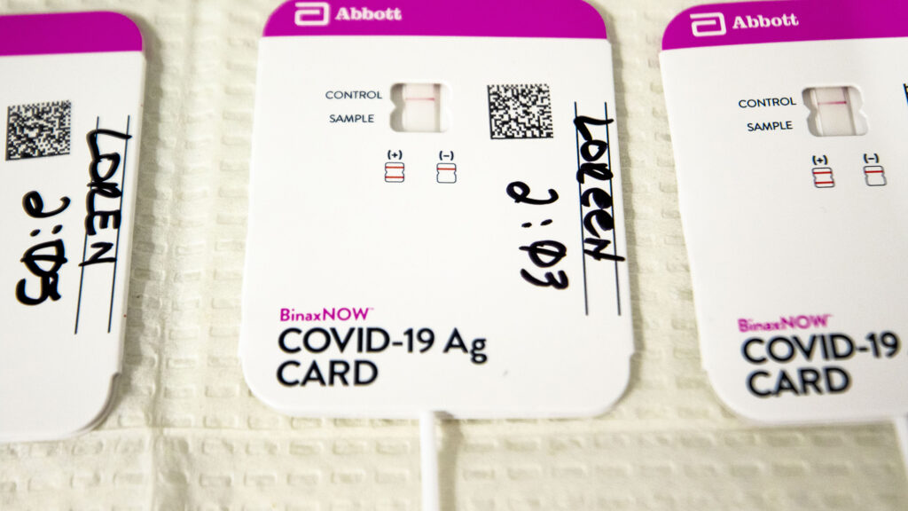 A COVID-19 rapid test in the lab at the Denver Indian Health and Family Services clinic in Sun Valley. Nov. 24, 2020.